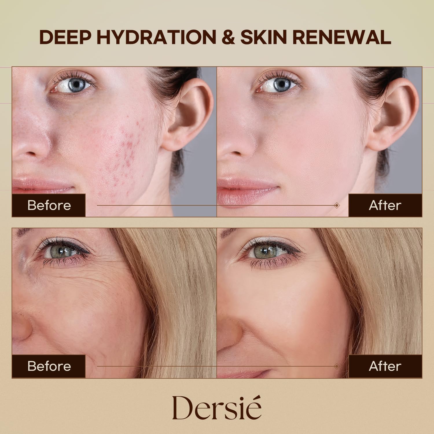 Huile de jojoba Dersie: réconfort et souplesse pour la peau.