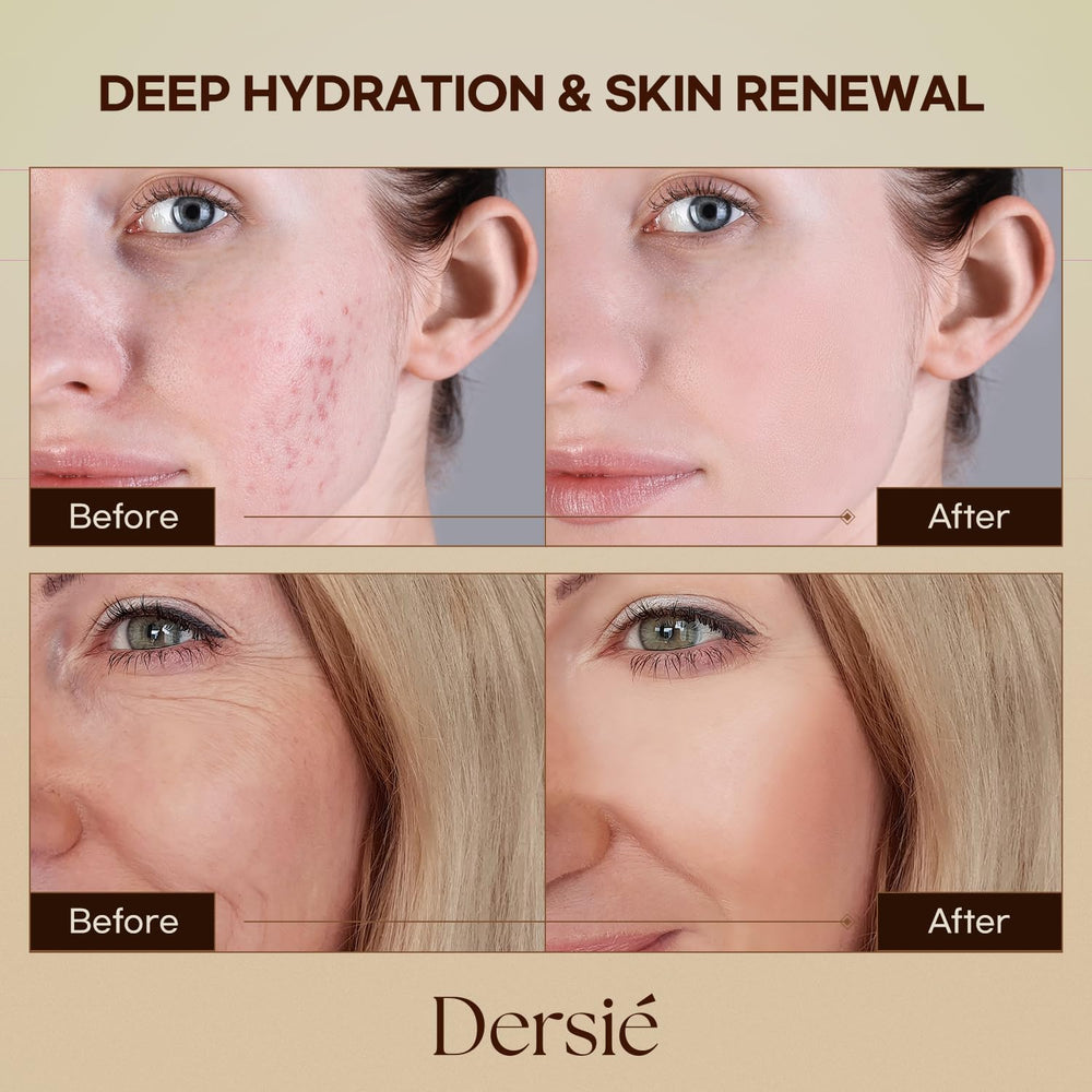 Huile de jojoba Dersie: réconfort et souplesse pour la peau.