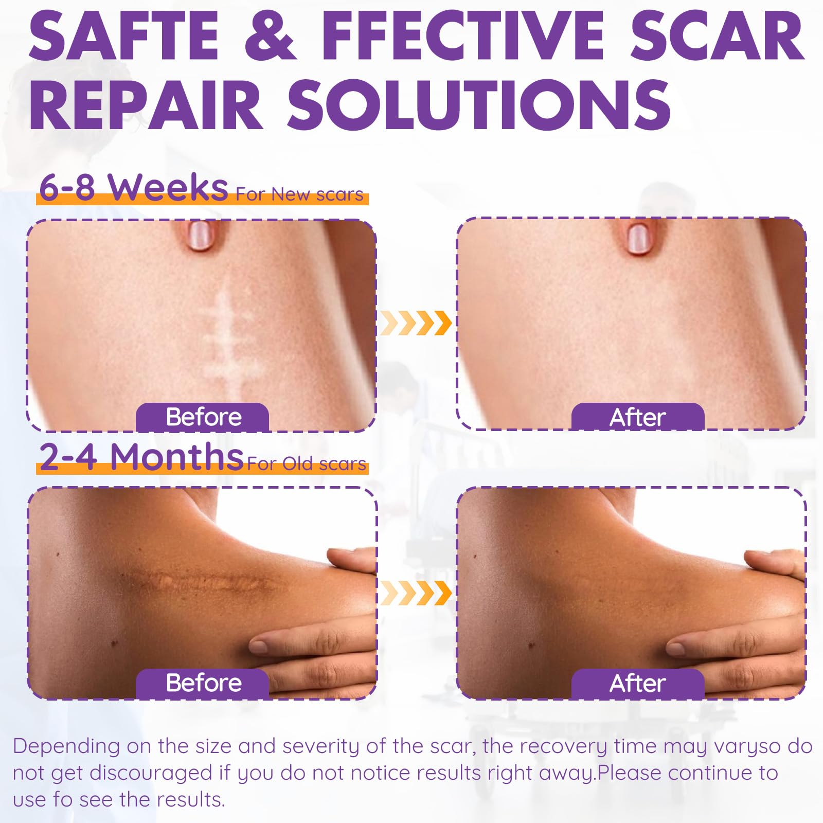 DFK bandes silicone cicatrice ergonomiques épousent la forme de la cicatrice pour une utilisation discrète.
