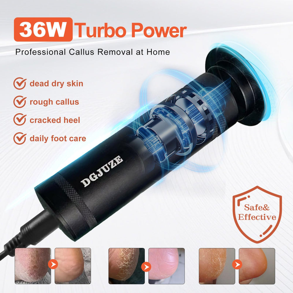 60 disques abrasifs inclus pour différentes zones des pieds.