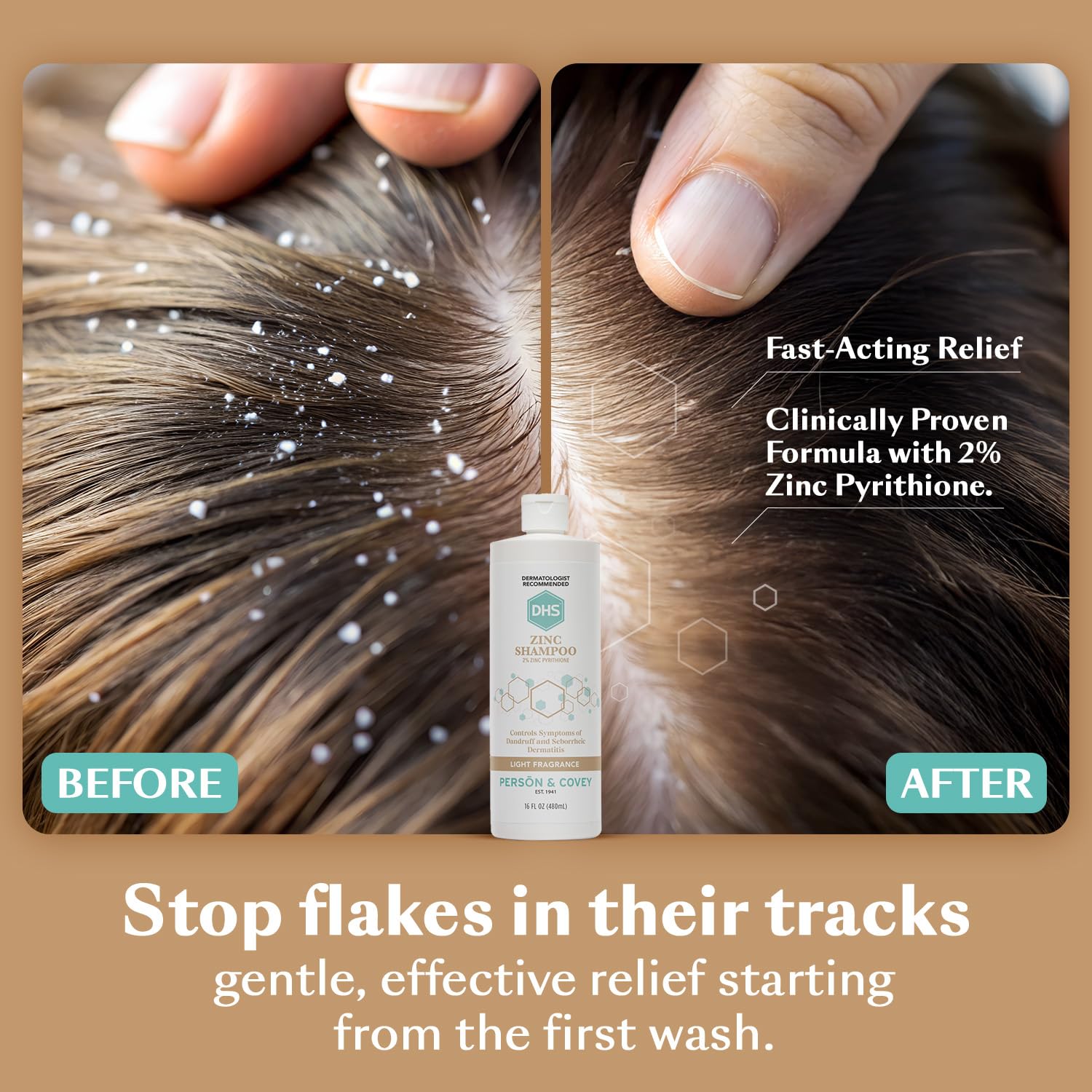 DHS Zinc Shampoo, pellicules visibles, nettoie et apaise le cuir chevelu.