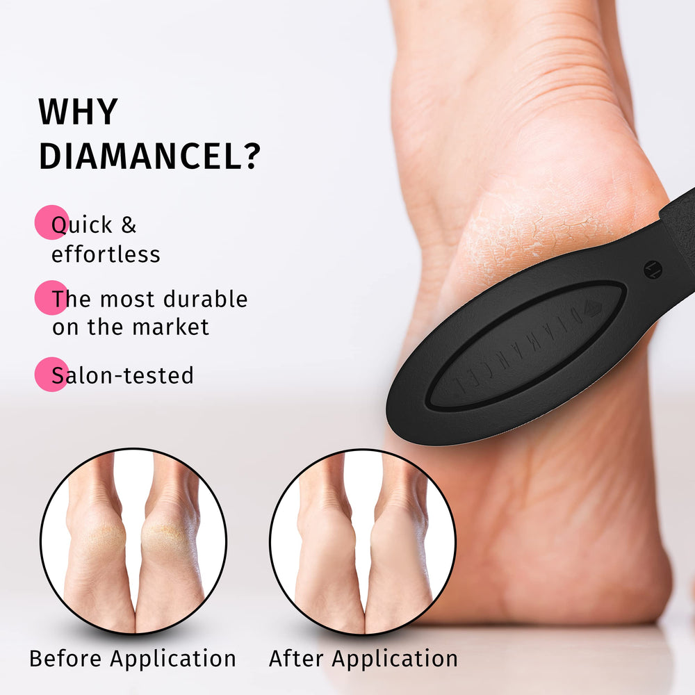 Buffer-pied Diamancel diamant grain moyen détail: surface abrasive naturelle assouplit les zones rugueuses.