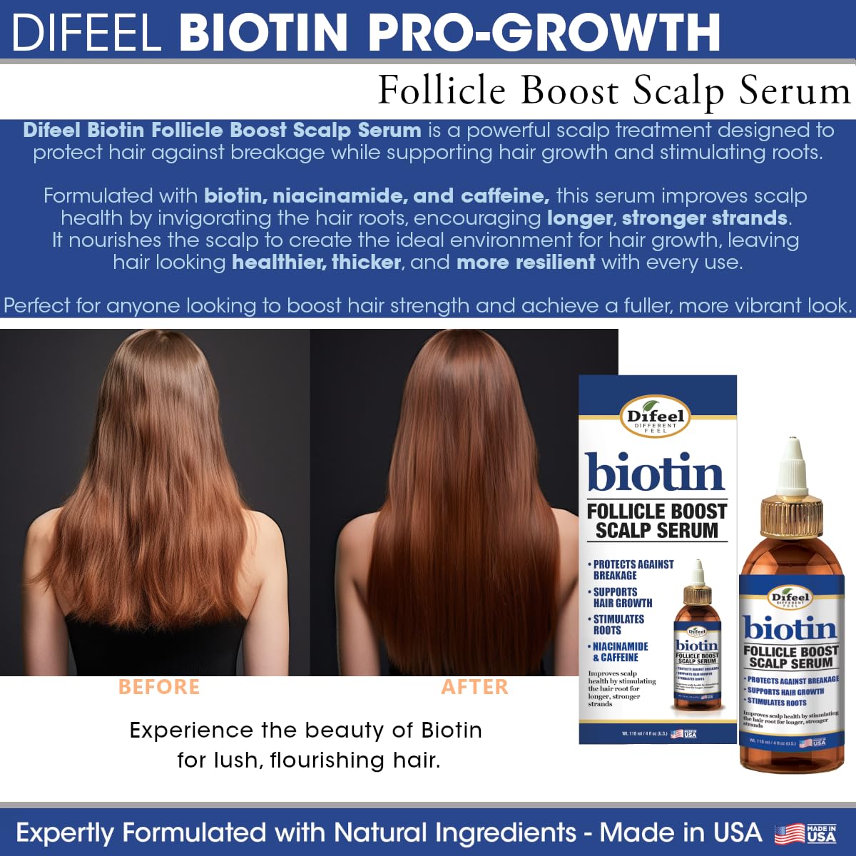 Difeel Sérum Biotine Niacine Caféine, cuir chevelu en douceur pour nourrir les racines