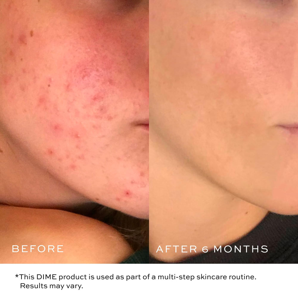 Application-massage-visage-circulaire avec le gel DIME Beauty pour une routine agréable.