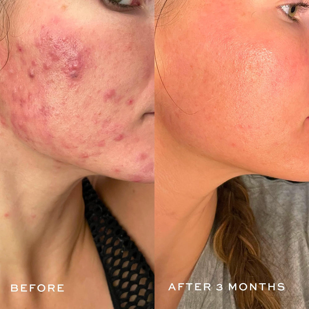DIME Beauty nettoyant visage équilibre le pH et respecte le microbiome cutané.