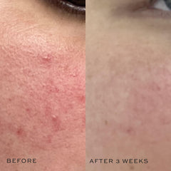 DIME Mini Super Skin Toner, extrait de concombre, apaise et rafraîchit.