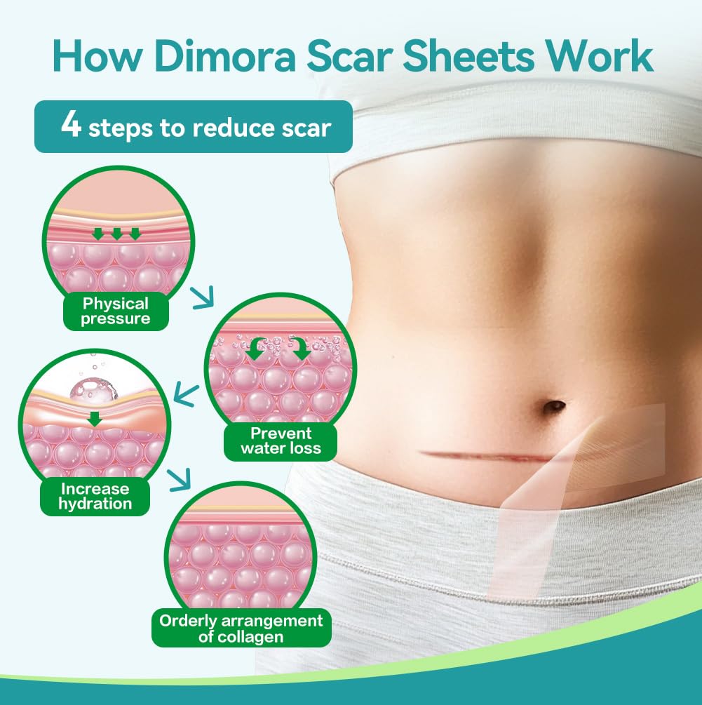Surface silicone Dimora lavable et réutilisable après séchage.