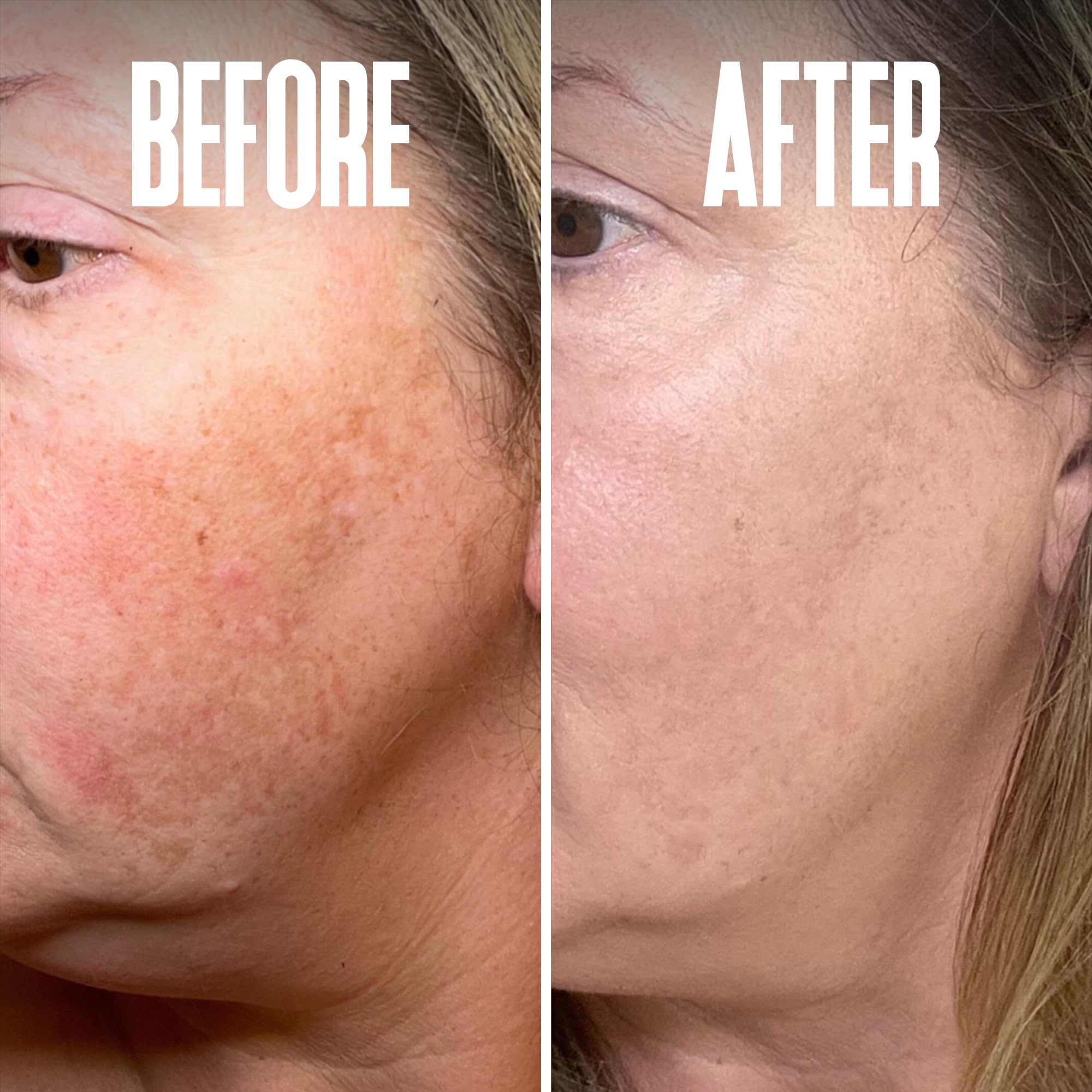 Divine Derriere Pour Visage et Corps: zones faciales et corporelles éclaircies