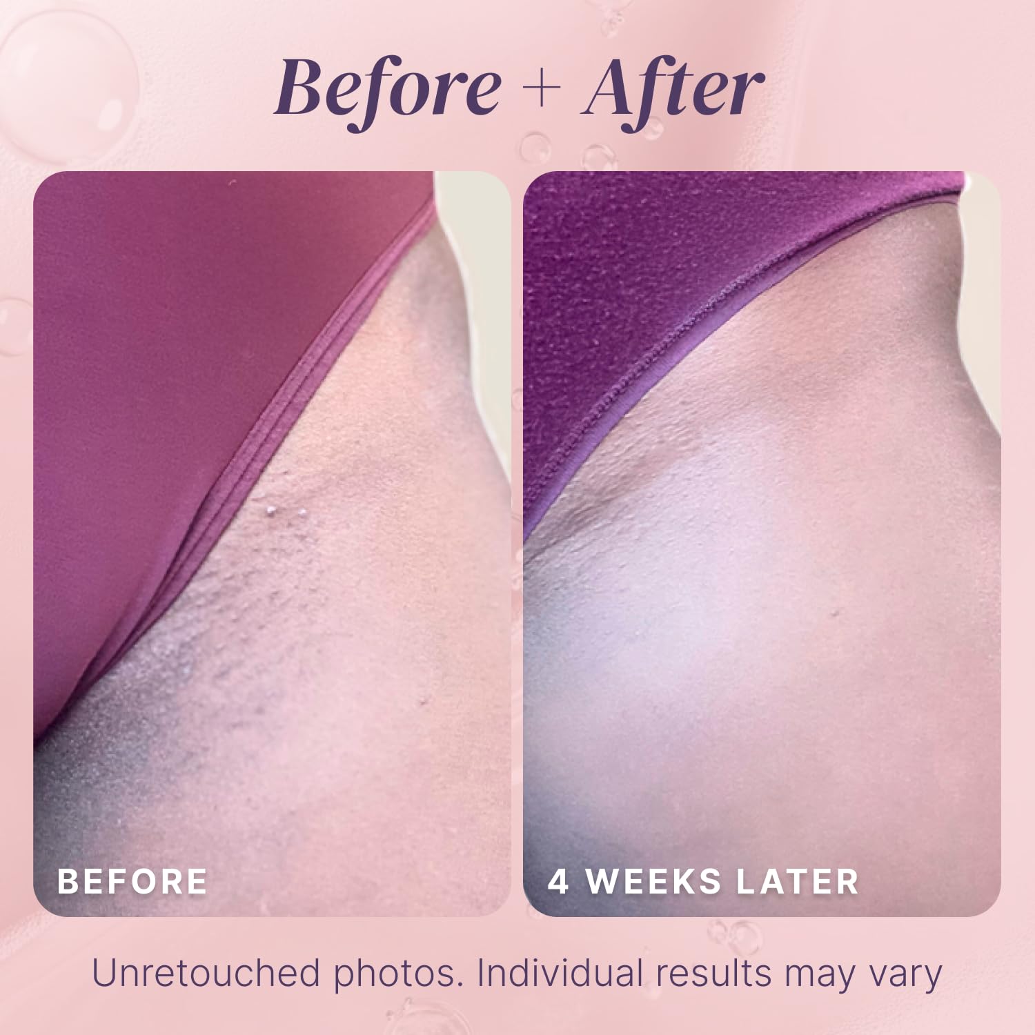 Divine Derriere Razor Bump Stopper – utilisation douce sur la zone bikini