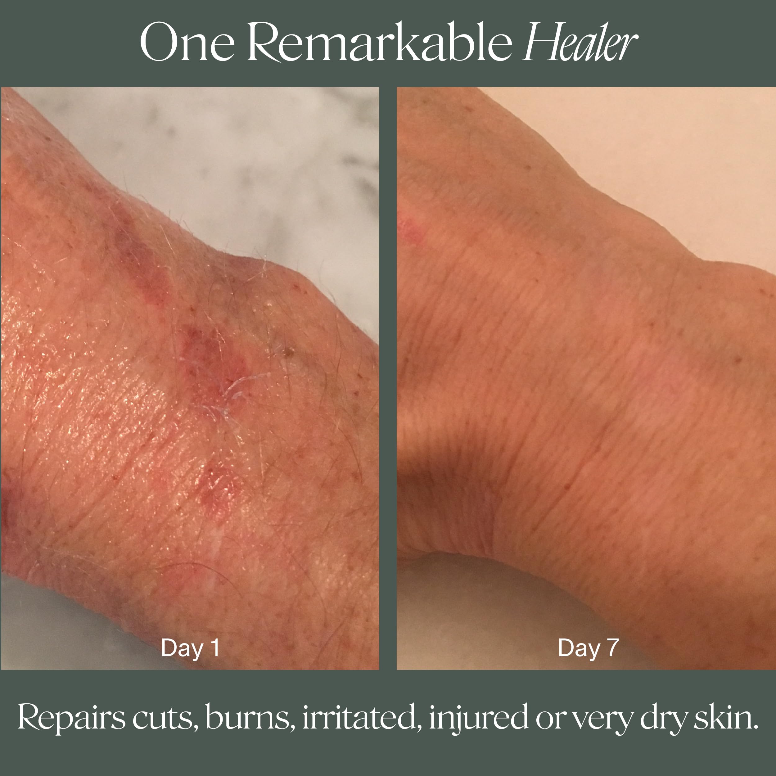 Doctor Rogers Restore Balm crée une barrière protectrice sur la peau