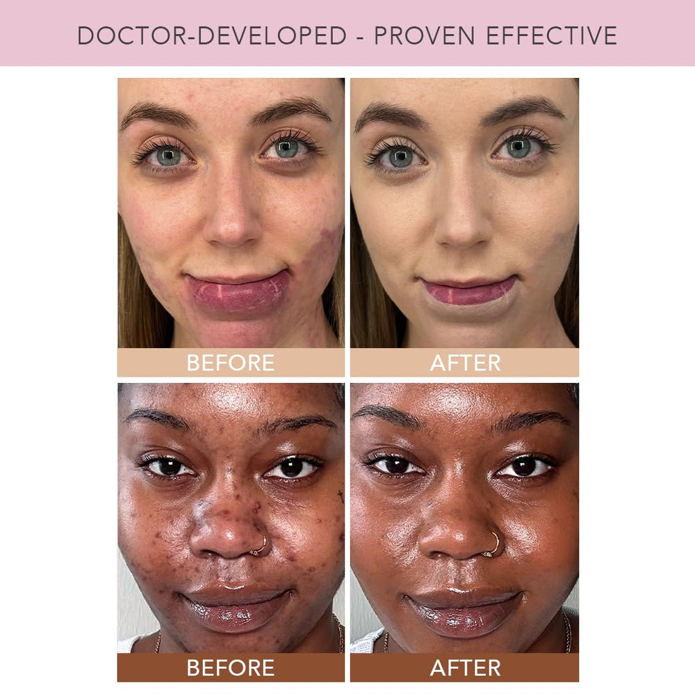 Éclat naturel et hydratation légère Doll 10 NO tout au long de la journée.