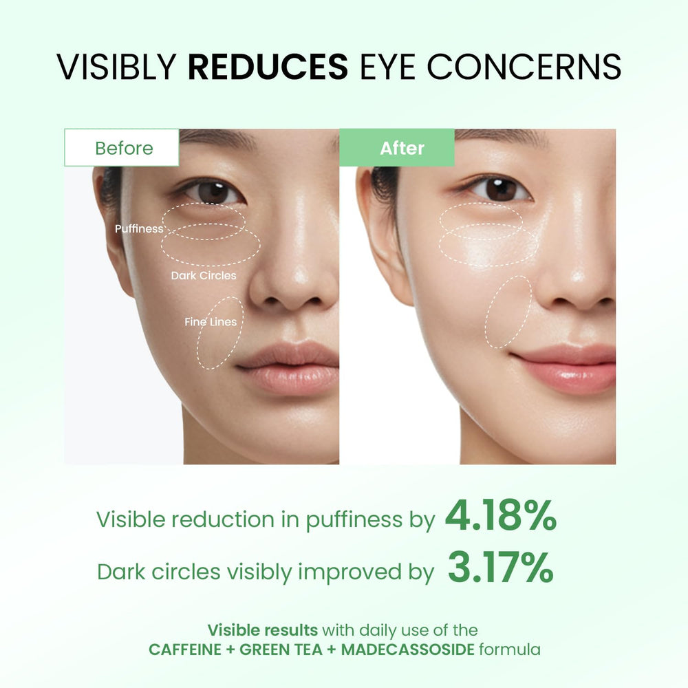 Dongyu Crème Yeux Anti-Âge Roll-on 360°, application fluide et dégonfle les poches.