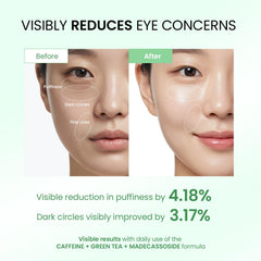 Dongyu Crème Yeux Anti-Âge Roll-on 360°, application fluide et dégonfle les poches.