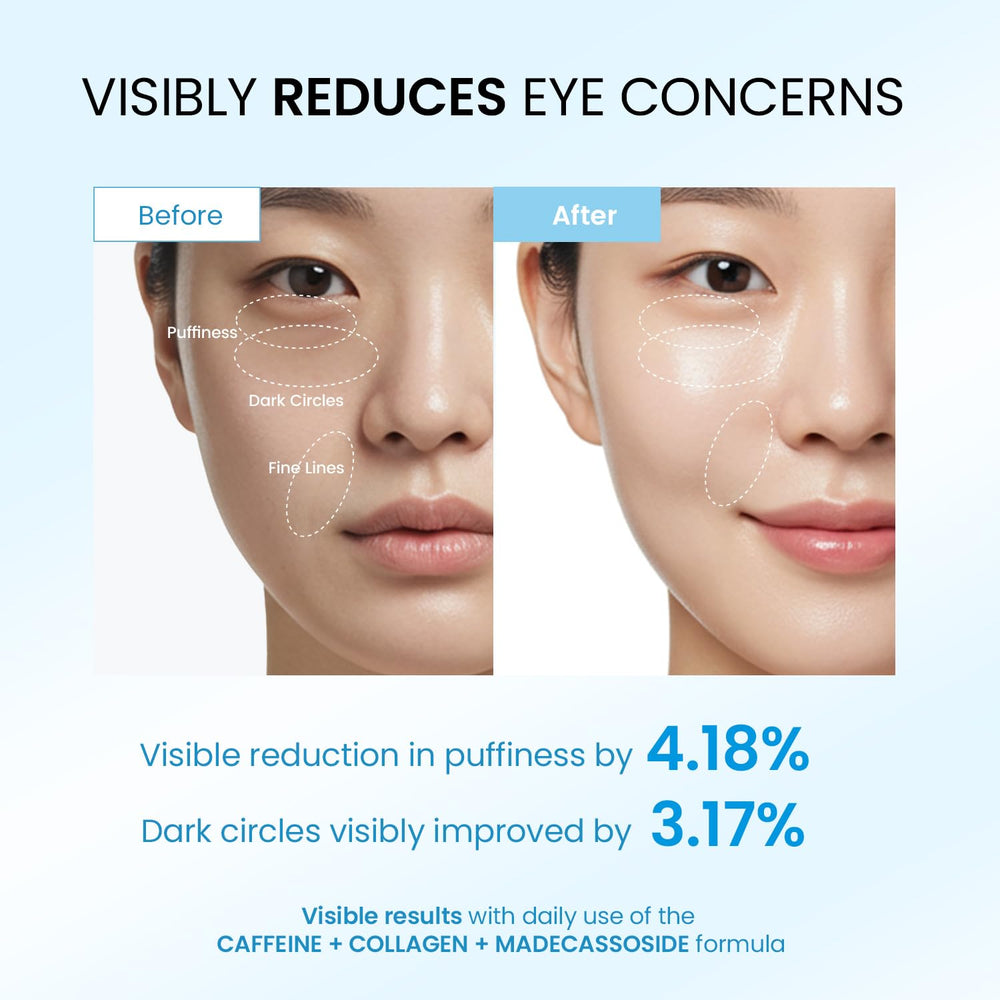 Dongyu roller 360°, applicateur qui masse et améliore l’absorption autour des yeux.