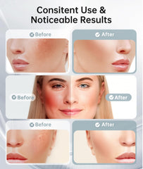 Dopsikn vibration reglable visage pour un soin ciblé