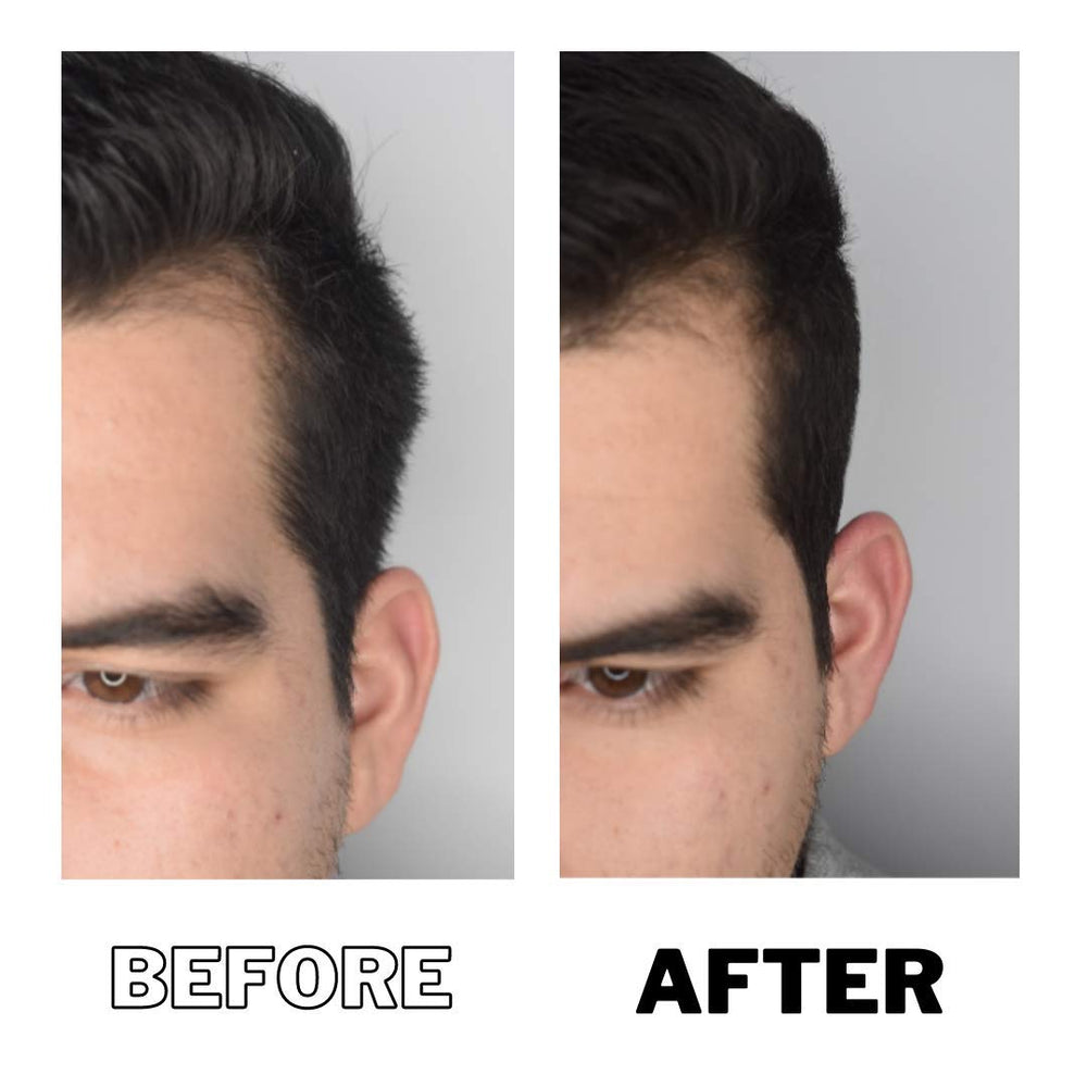 DPERM Temps d’application guidé pour une routine simple et efficace.