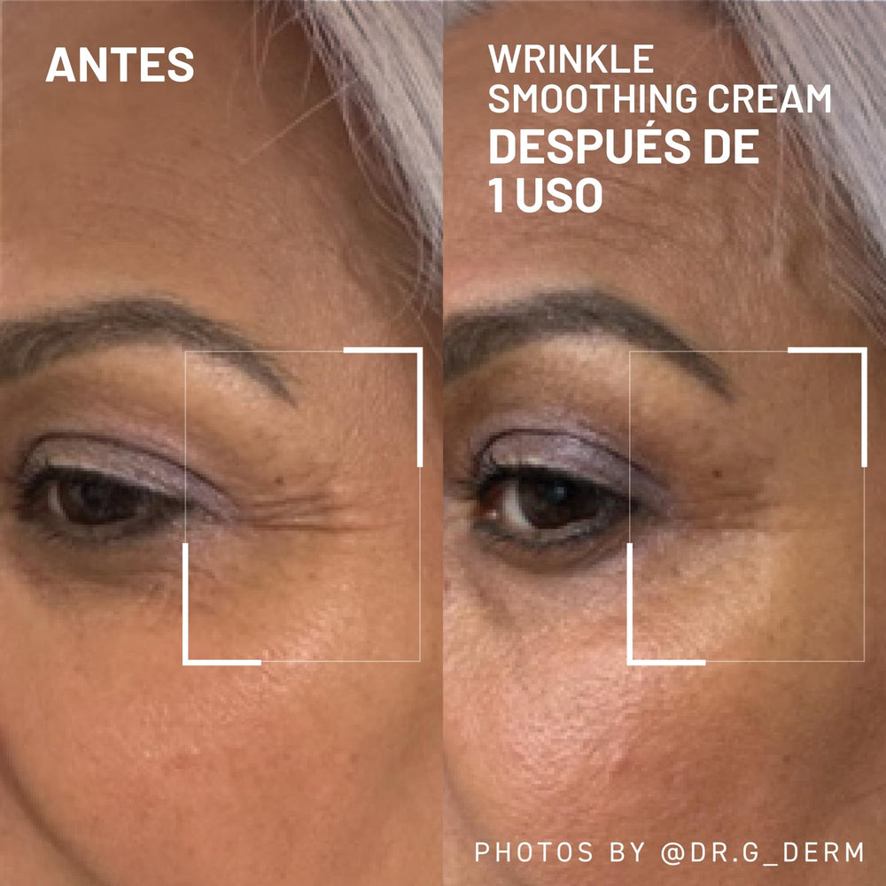 Dr Brandt Needles No More: application frontale ciblée pour lisser les rides.