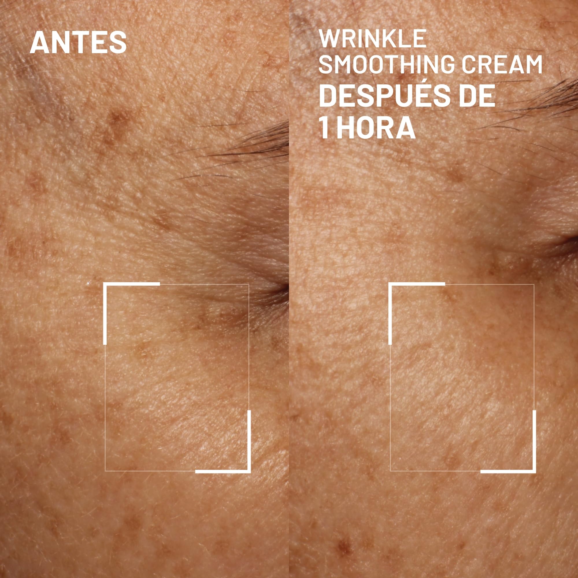Dr Brandt Needles No More: flacon crème visage prêt à l’emploi.