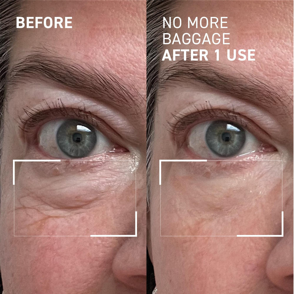 Dr Brandt Needles No More – Filmatrix, seconde peau qui serre légèrement le contour.