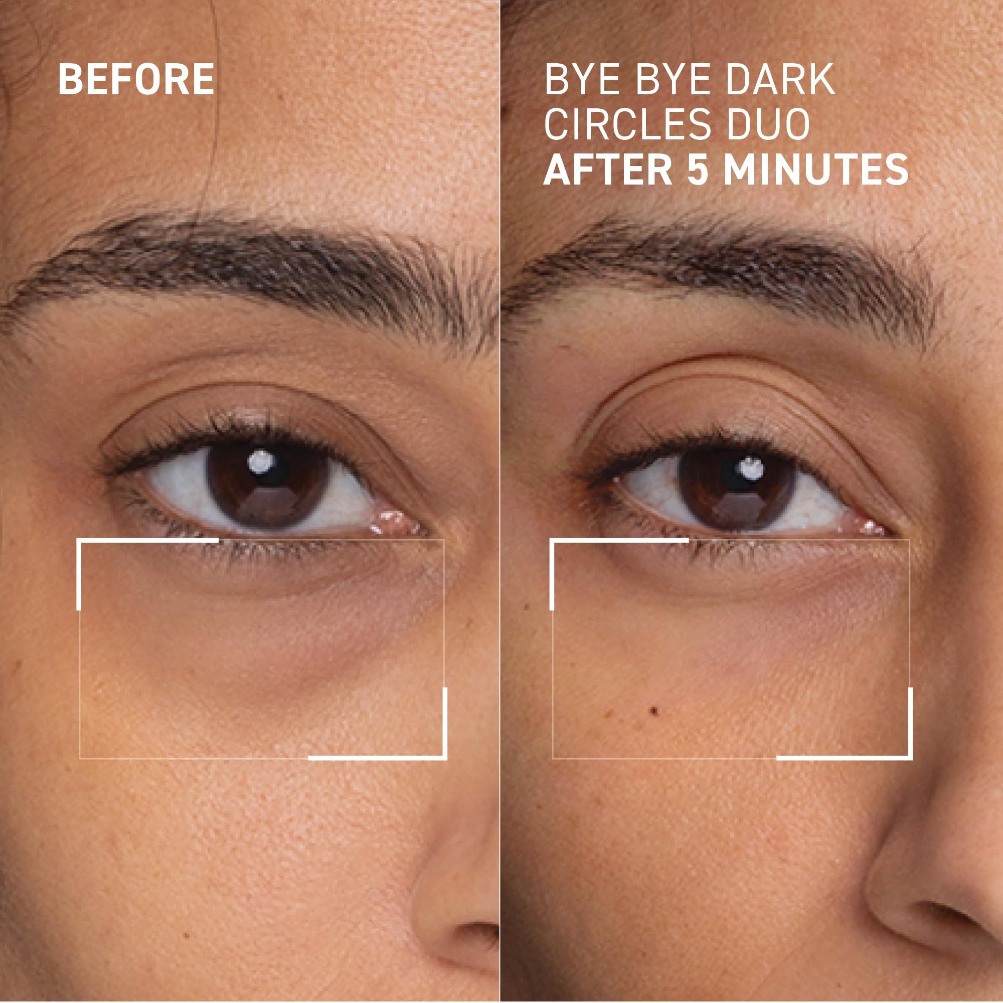 Dr Brandt No More Baggage: réduction visuelle des poches sous les yeux.