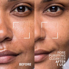 Texture gel douce et mousse légère Dr Brandt Pores No More.