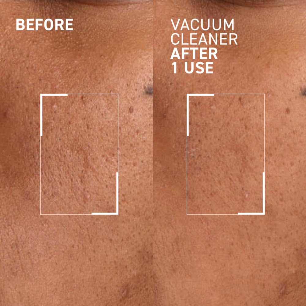 Dr. Brandt Pores No More – masque purifiant en crème pour nettoyer les pores.