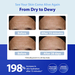 Pompe du sérum HydroShield prête à délivrer une dose homogène.
