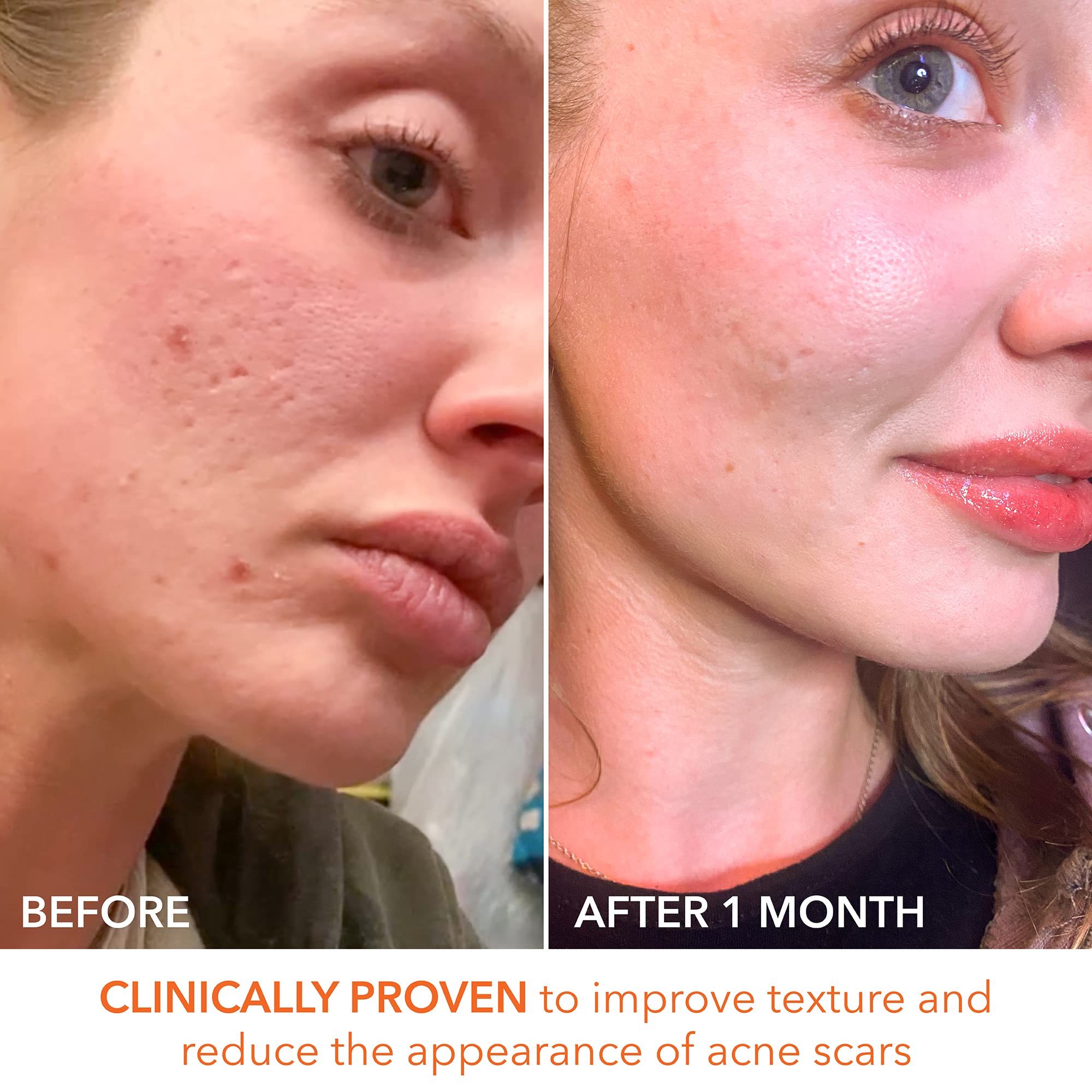 Dr Dennis Gross Alpha Beta Extra Strength Daily Peel – radiance et douceur après application