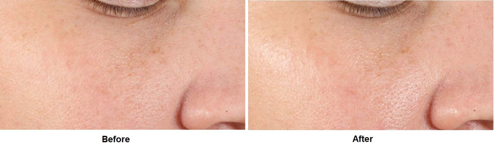 Dr. Dennis Gross Alpha Beta Serum, application quotidienne, peau hydratée.