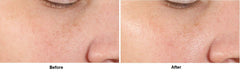 Dr. Dennis Gross Alpha Beta Serum, application quotidienne, peau hydratée.