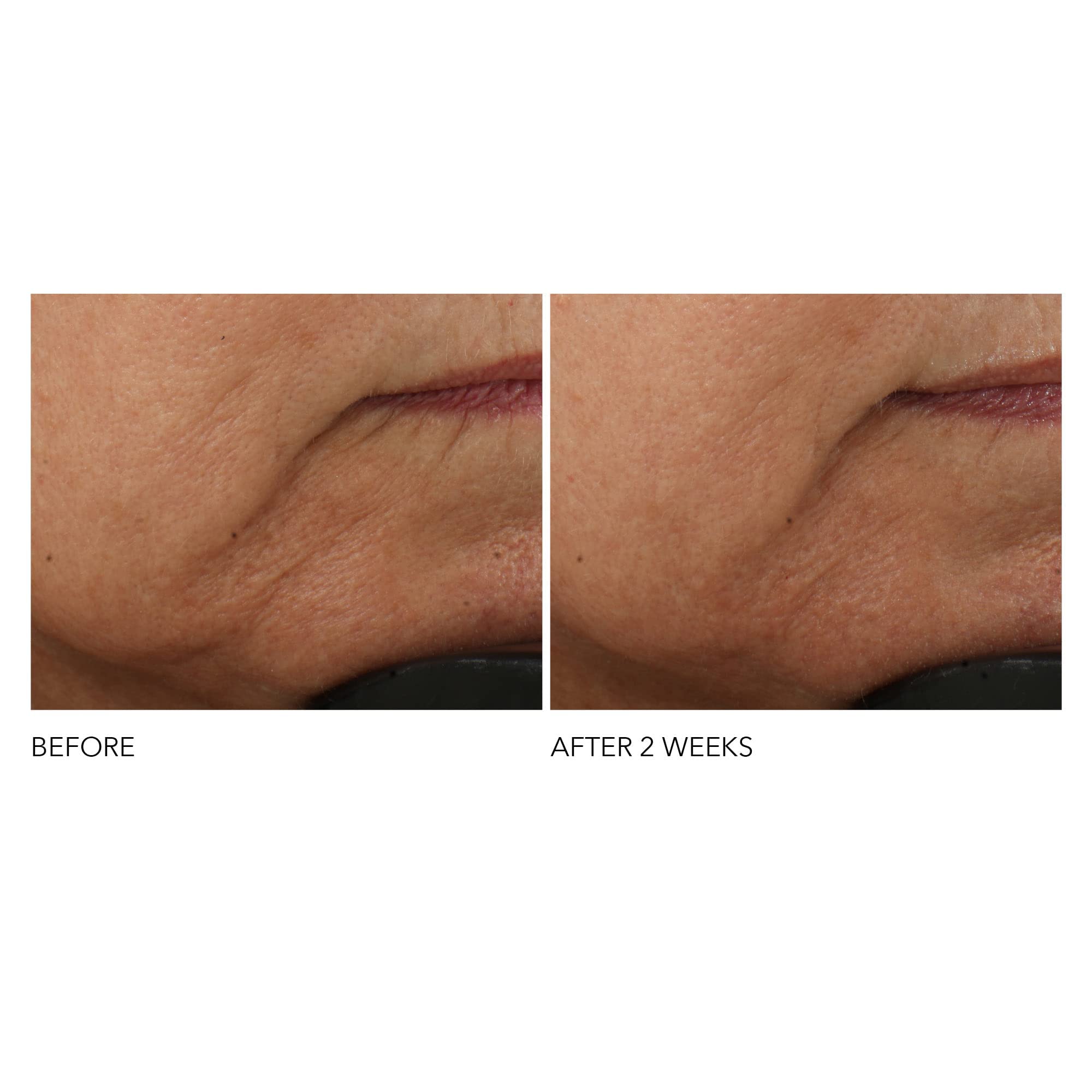 Texture soyeuse de la crème Dr Dennis Gross pour le visage.