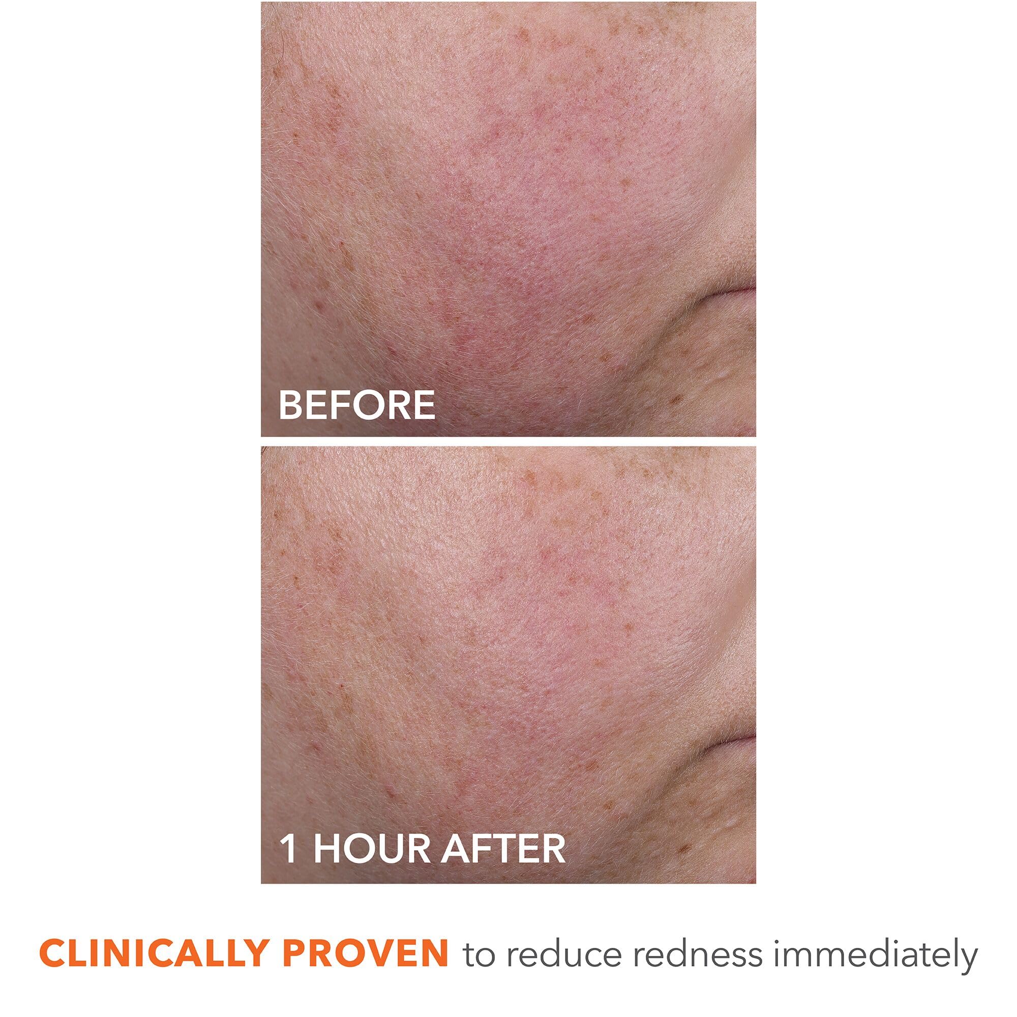 Routine AM/PM avec DermInfusions après peeling et sérum, peau prête pour maquillage.