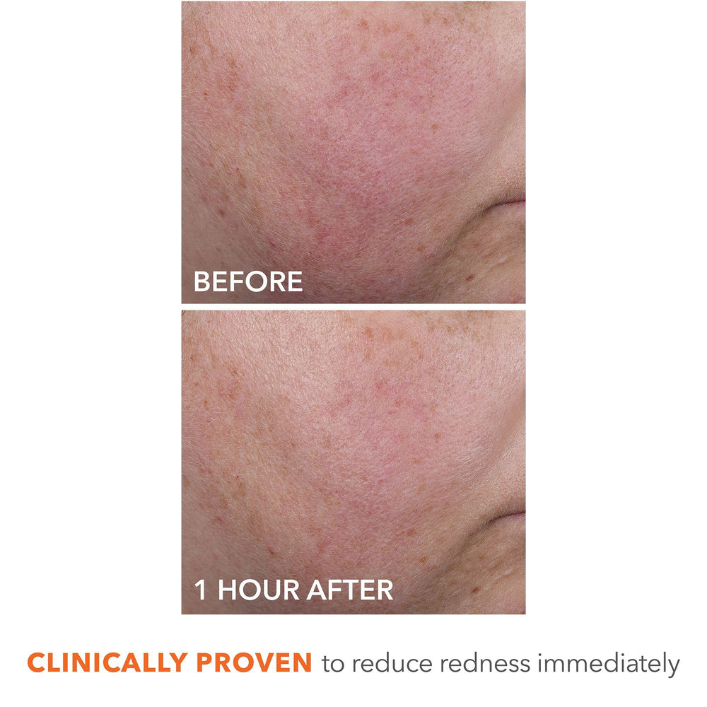 Routine AM/PM avec DermInfusions après peeling et sérum, peau prête pour maquillage.