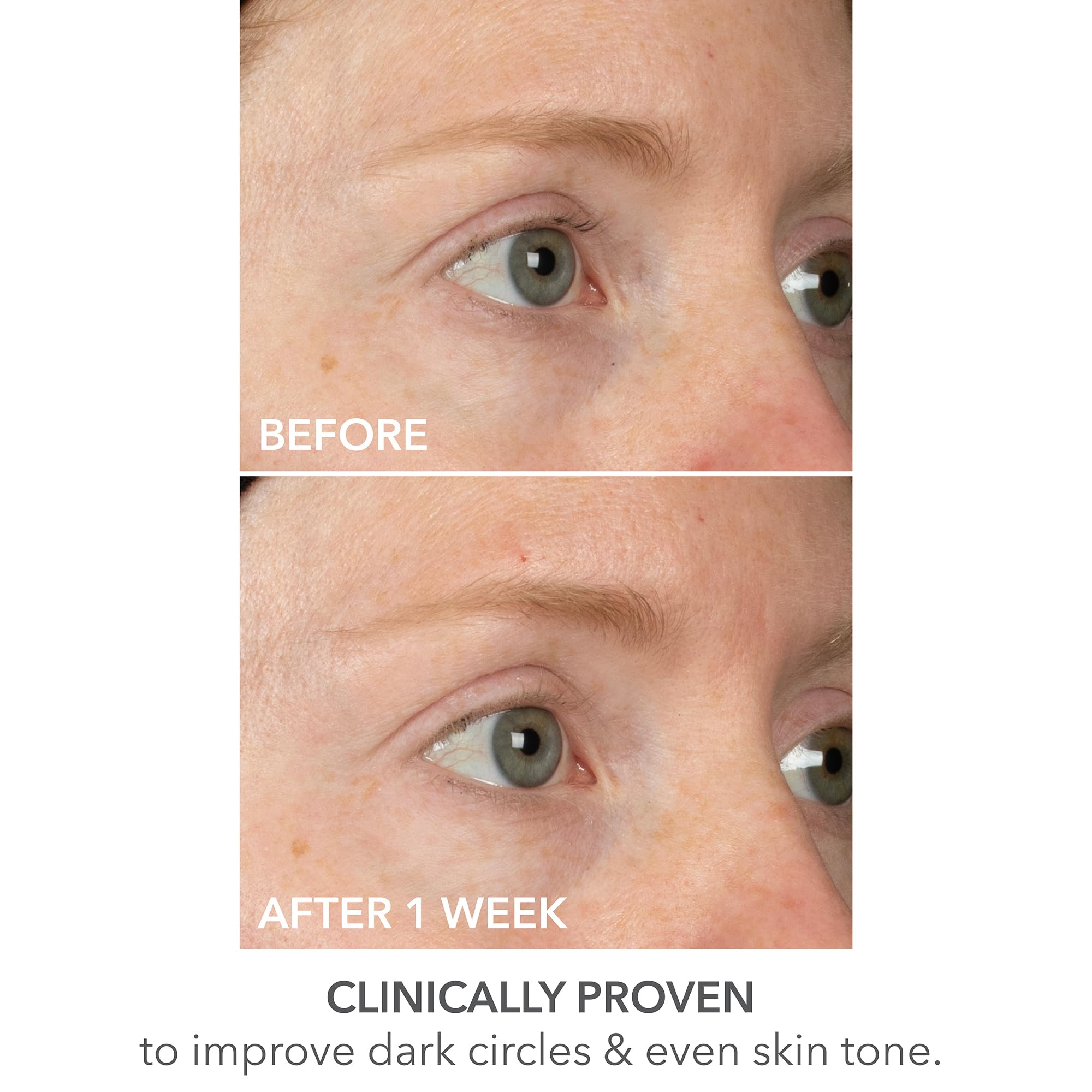 Utilisation associée au SpectraLite pour soins complémentaires des yeux.