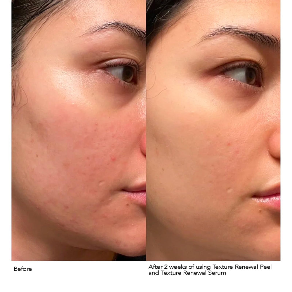 Ingrédients Phyto-Retinol Blend: rétinol, bakuchiol, ramboutan et acide férulique.
