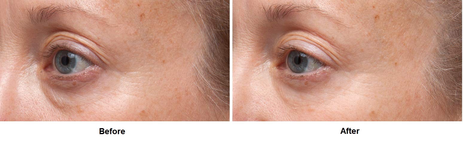 Dr Dennis Gross Sérum Yeux Ferulic Retinol – base maquillage efficace.