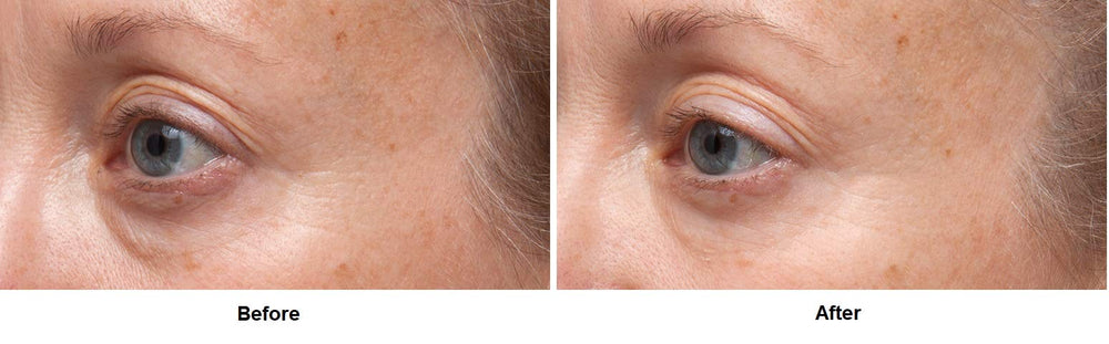 Dr Dennis Gross Sérum Yeux Ferulic Retinol – base maquillage efficace.