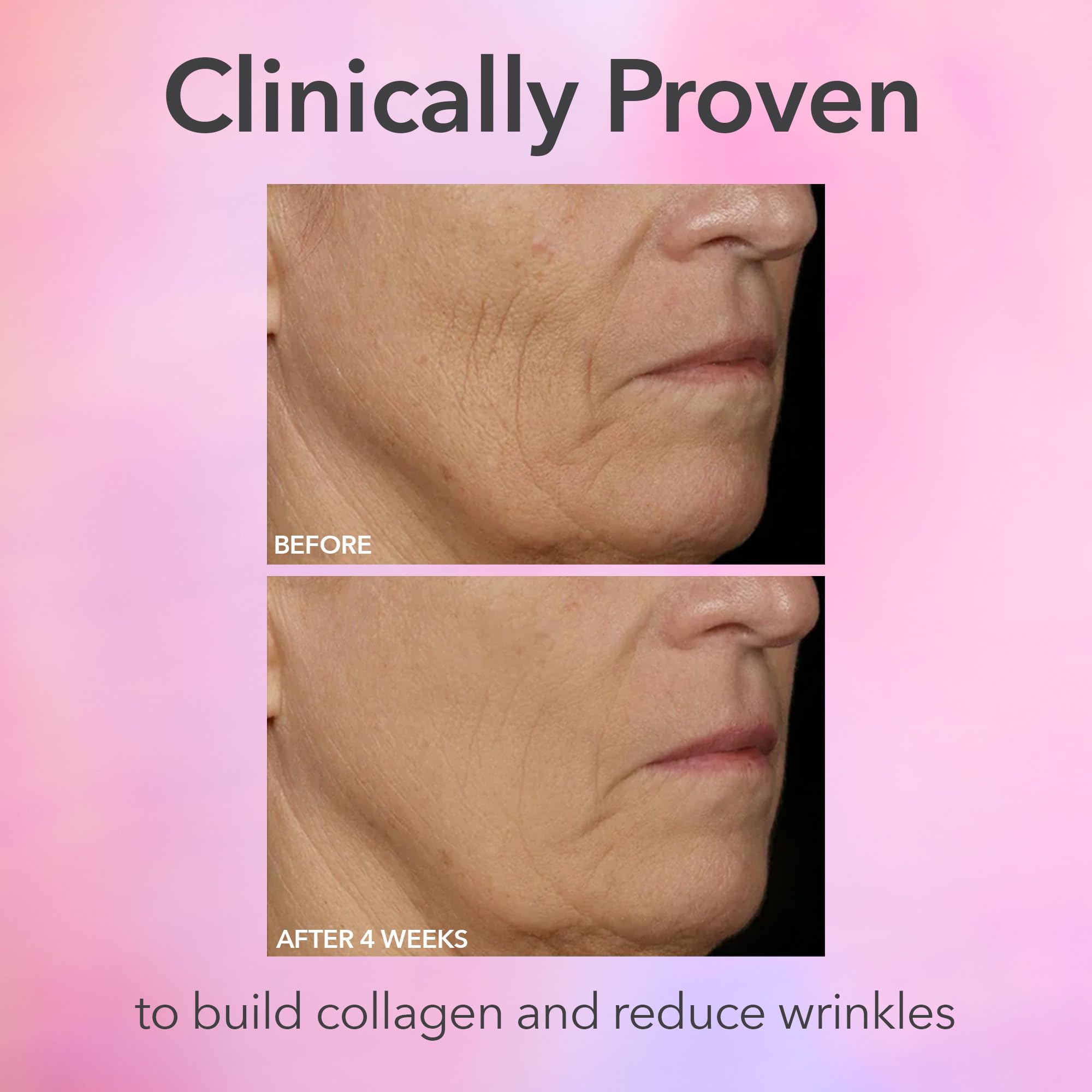 Dr Dennis Gross DRx SpectraLite FaceWare Pro – lumière rouge pour un teint plus lumineux après soin.