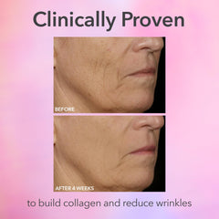 Dr Dennis Gross DRx SpectraLite FaceWare Pro – lumière rouge pour un teint plus lumineux après soin.