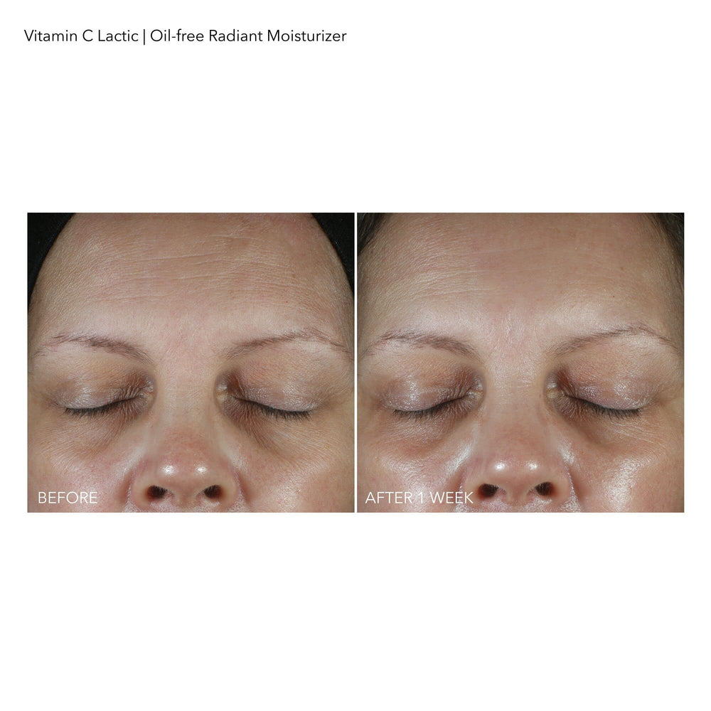 Dr Dennis Gross VitC+Lactic sans huile – geste d'application clair