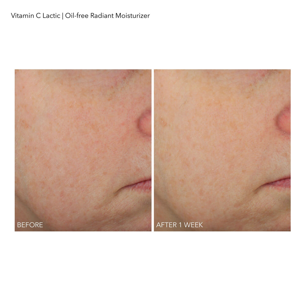 Dr Dennis Gross VitC+Lactic sans huile – ingrédients clés détaillés