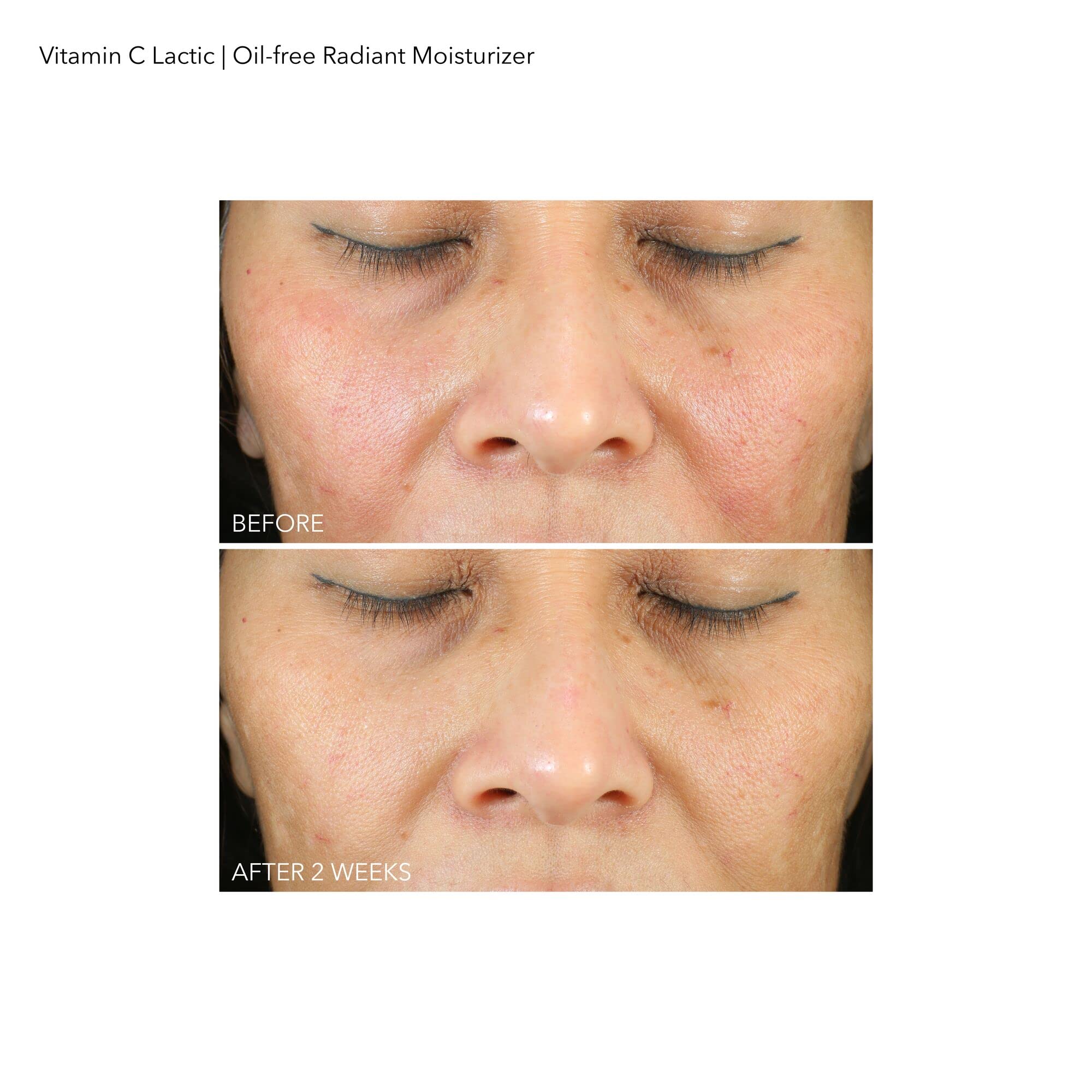 Dr Dennis Gross VitC+Lactic sans huile – rituel matin et soir pour un teint lumineux
