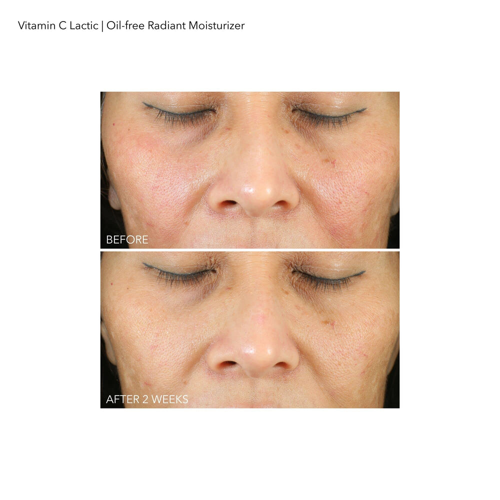 Dr Dennis Gross VitC+Lactic sans huile – rituel matin et soir pour un teint lumineux