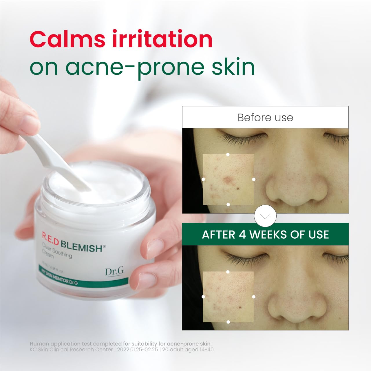 Dr.G R.E.D. Blemish Clear – complexe 10-Cica et actifs apaisants pour peau sensible.