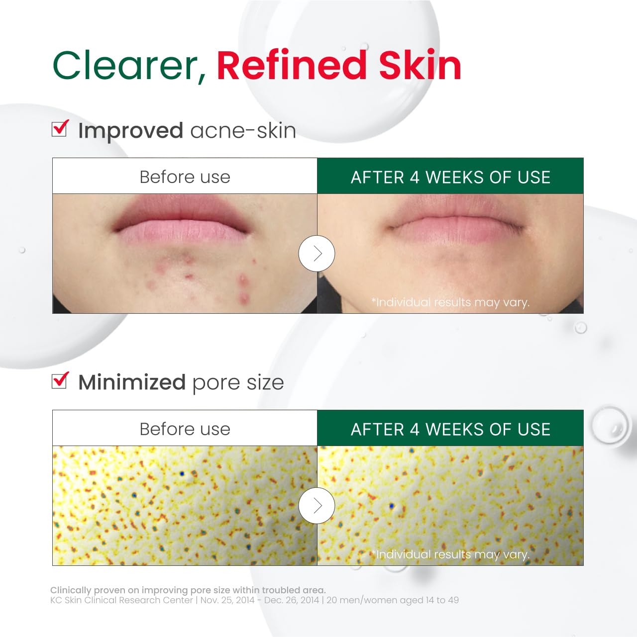 Dr. G R.E.D. Blemish Clear: application sur le visage avec peau hydratée.