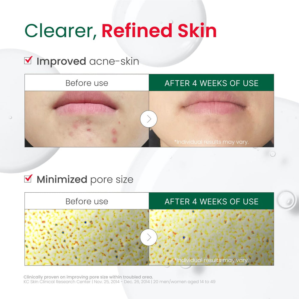 Dr. G R.E.D. Blemish Clear: application sur le visage avec peau hydratée.
