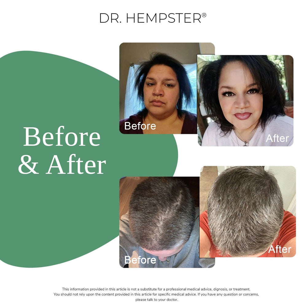 DR. HEMPSTER Biotine & Chanvre – image avant/après suggérant du volume.