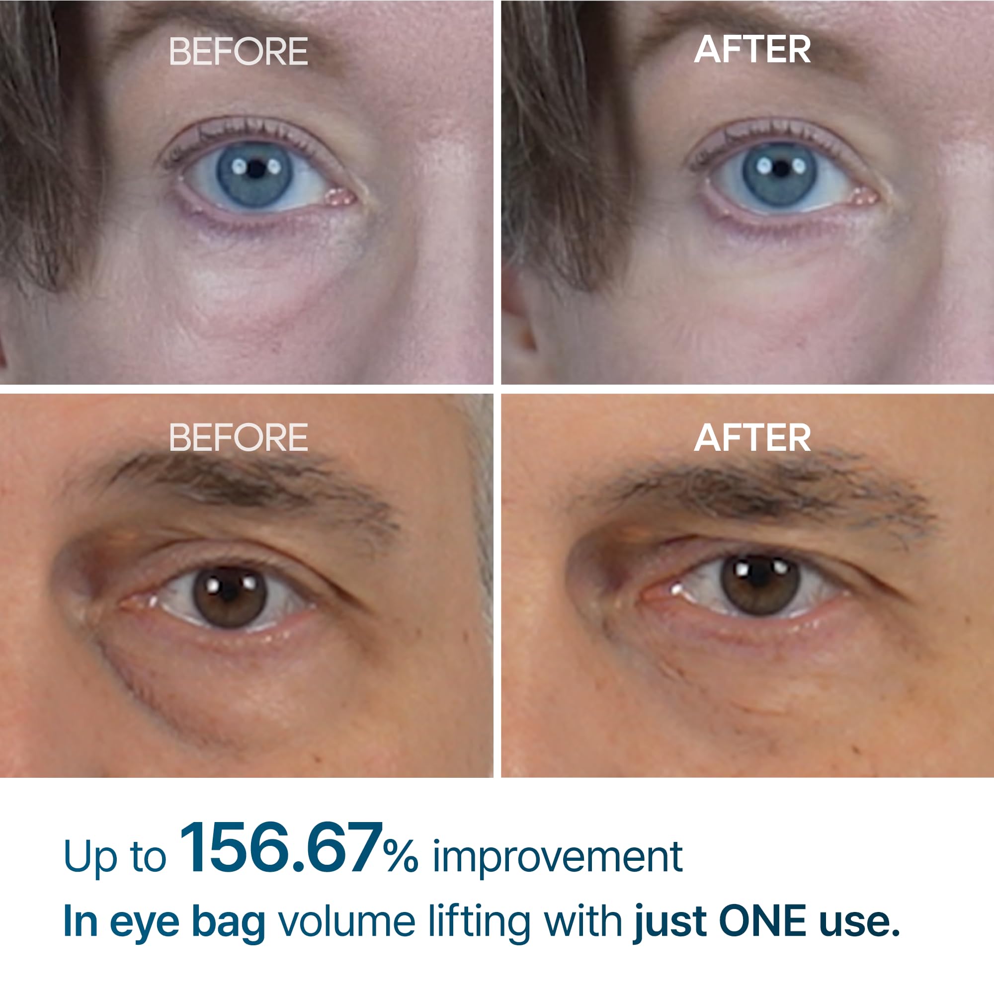 Application sous les yeux avec Crème Eyephalt Eyebag, sensation fraîche.