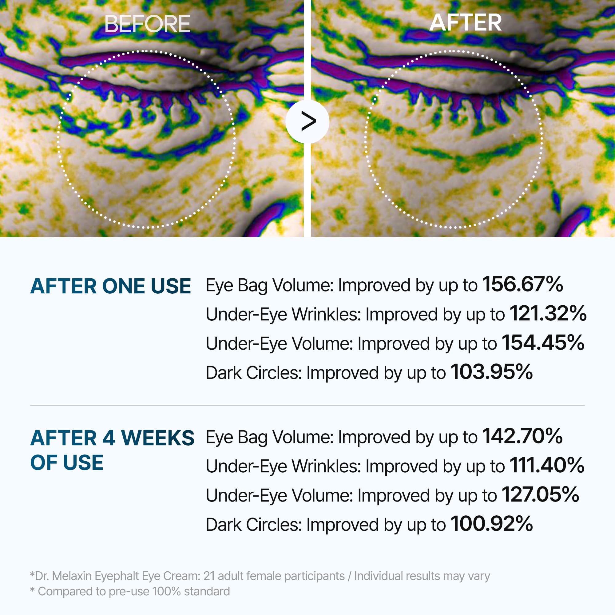 Emballage compact Eyephalt Eyebag Cream, idéal pour voyages.
