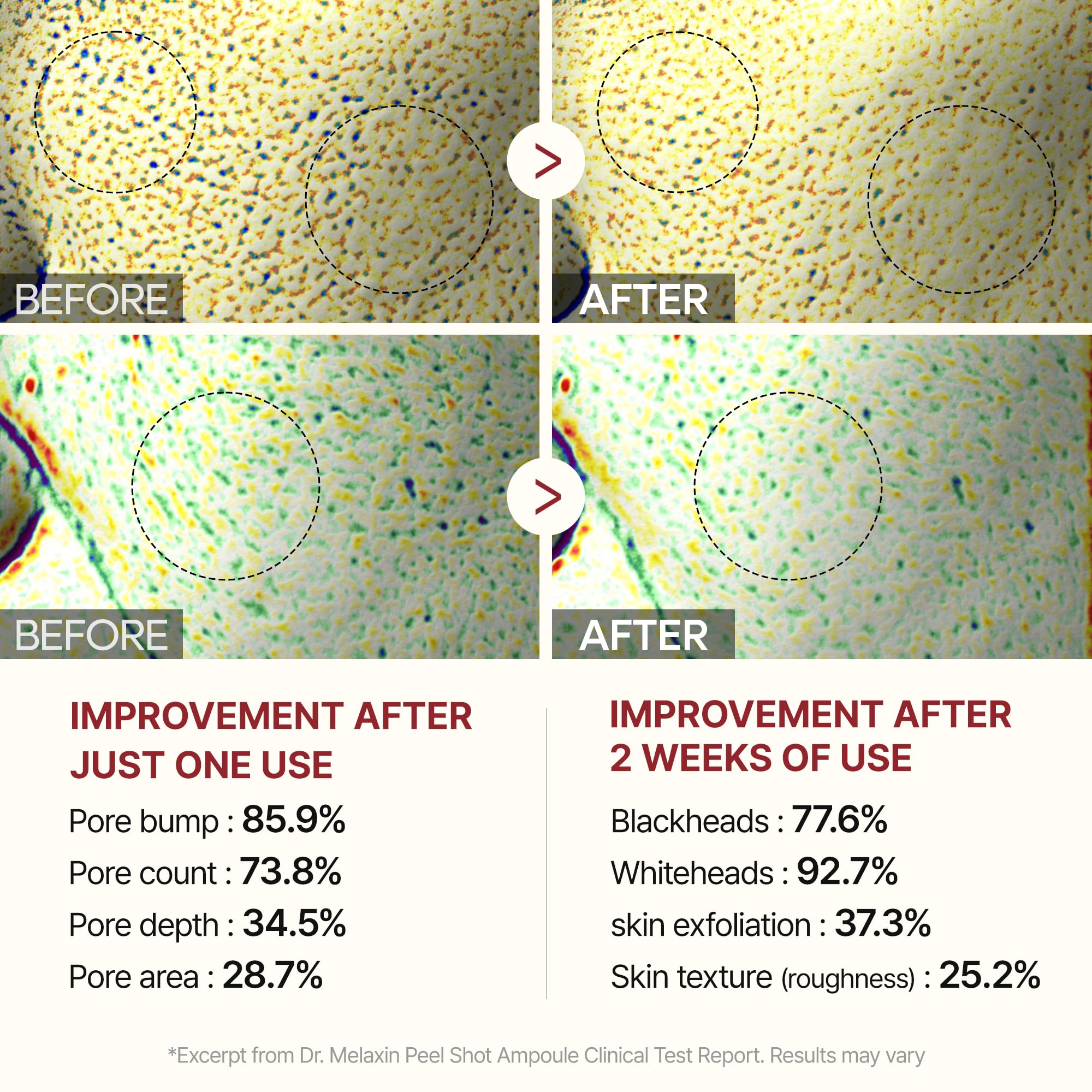 Exfoliation multi-niveaux AHA/BHA/PHA douce et efficace